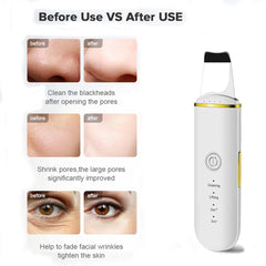 Ultrasonic Skin Cleanser